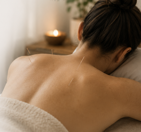 Acupuncture treatment in a calm, candlelit clinic room